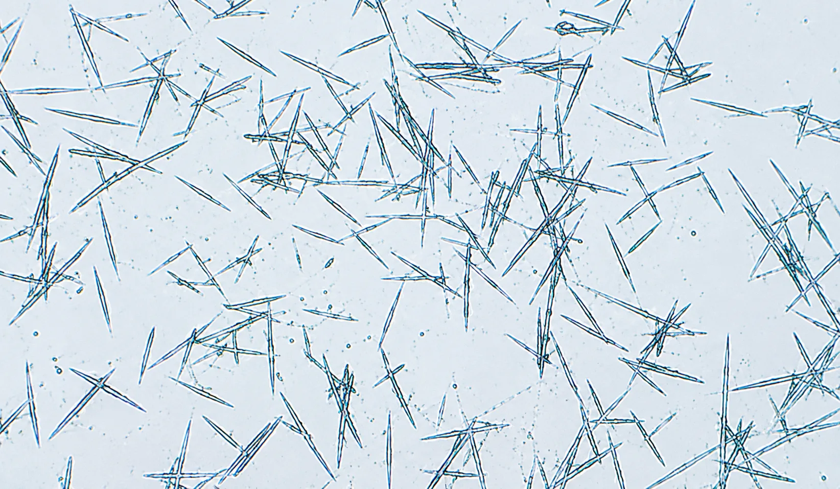 Microscopía: calcita (sarro)