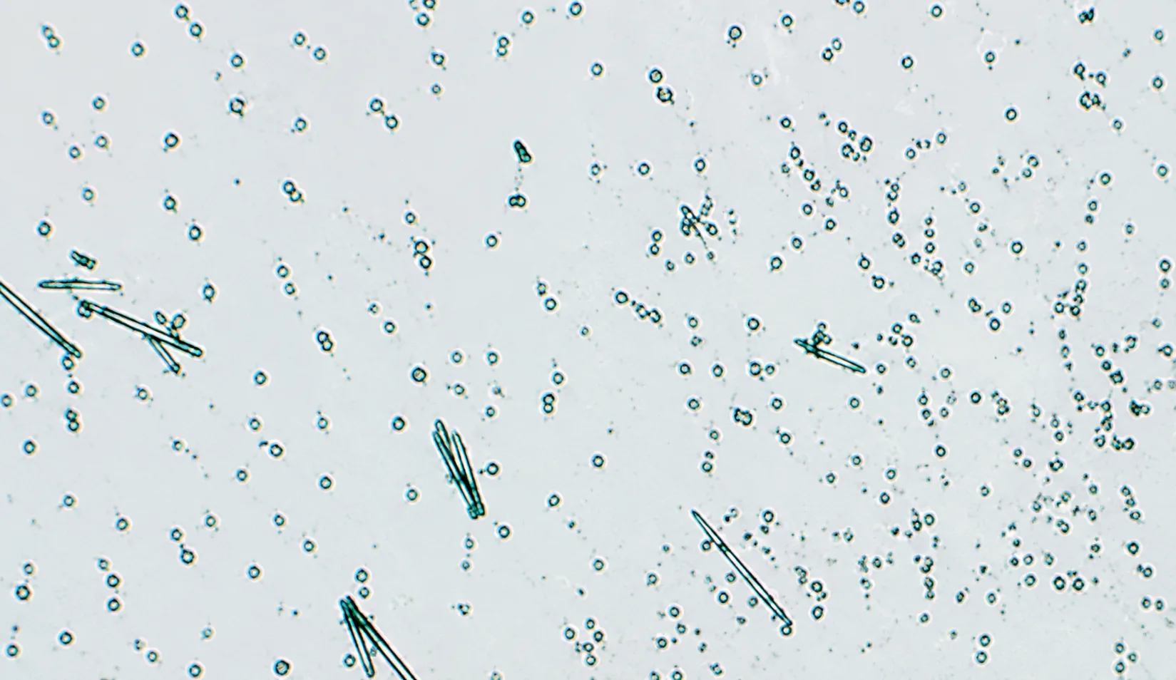 Microscopía: aragonita (sin sarro)